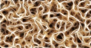 https://pixabay.com/en/nerves-cells-dendrites-sepia-791393/